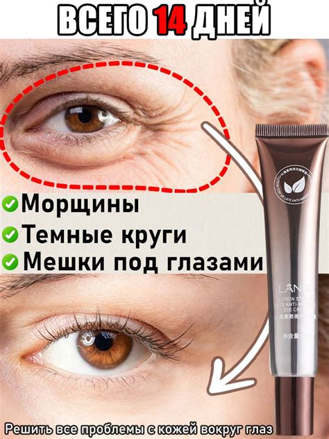 Уход за кожей вокруг глаз: убираем темные круги и морщины